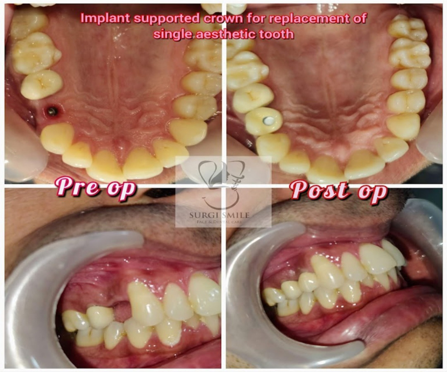 Dental Case 6