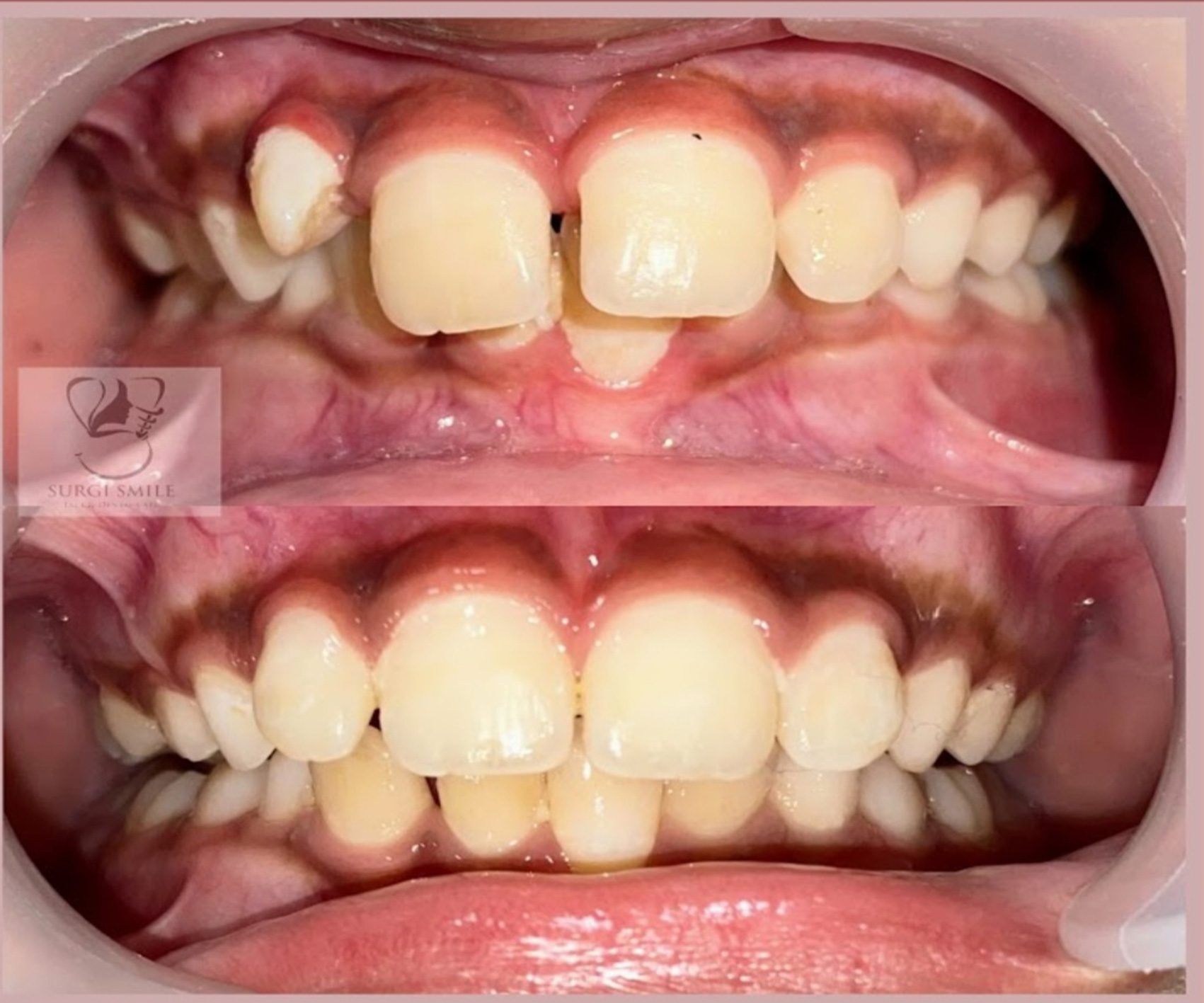 Dental Case 7